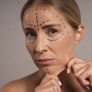 SCULPTRA® – COLLAGEN STIMULATING TREATMENT